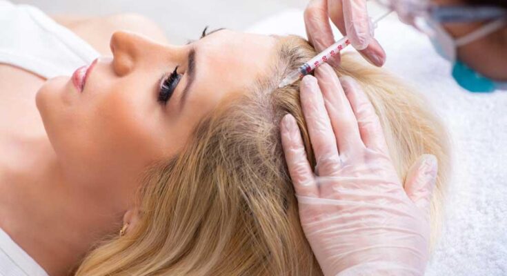 female pattern baldness treatment